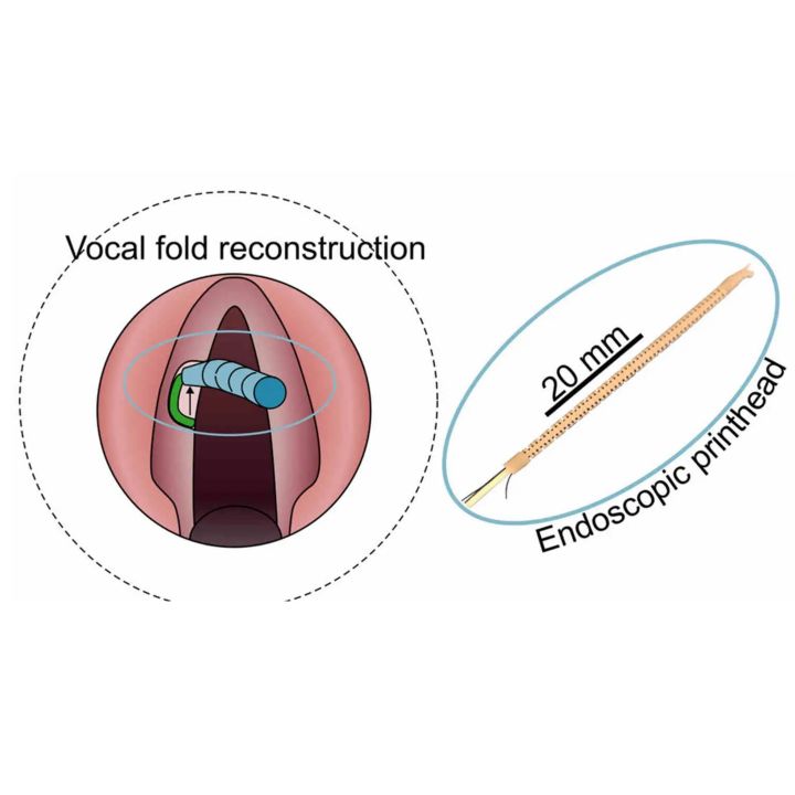 Une bio-imprimante miniature répare les cordes vocales avec précision - Sciences & Santé -
                    Luxe radio