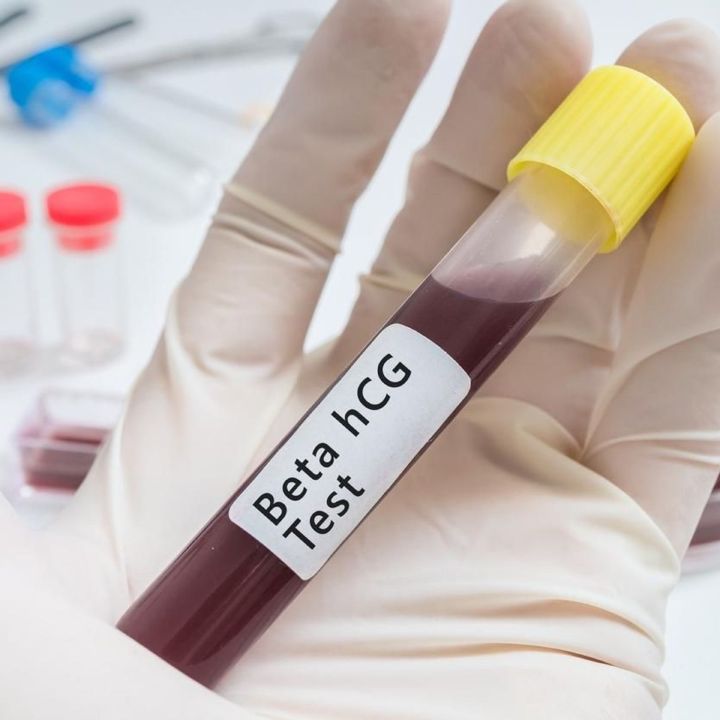 Taux bêta-hcg : comment interpréter les dosages? - Les Invités de Heure Essentielle -
                    Luxe radio