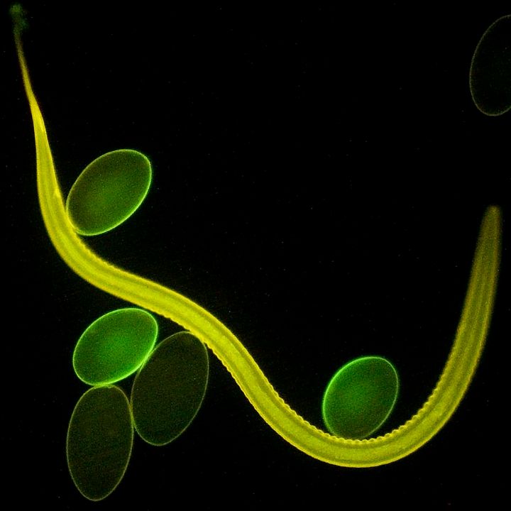 Comment un parasite mortel se déguise pour tromper nos défenses immunitaires - Sciences & Santé -
                    Luxe radio