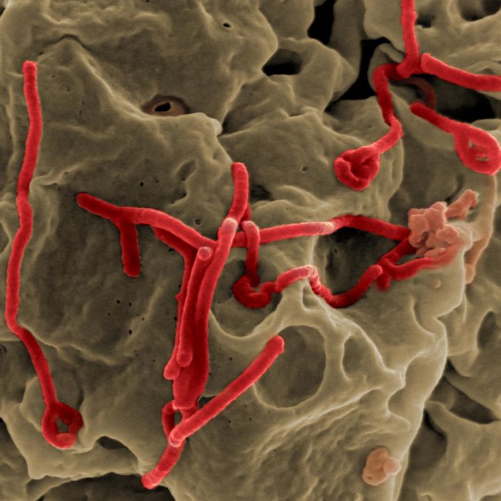 Des rumeurs sur la présence d’Ebola au Gabon. Ce qu’en dit le ministre gabonais de la santé - Sciences & Santé -
                    Luxe radio