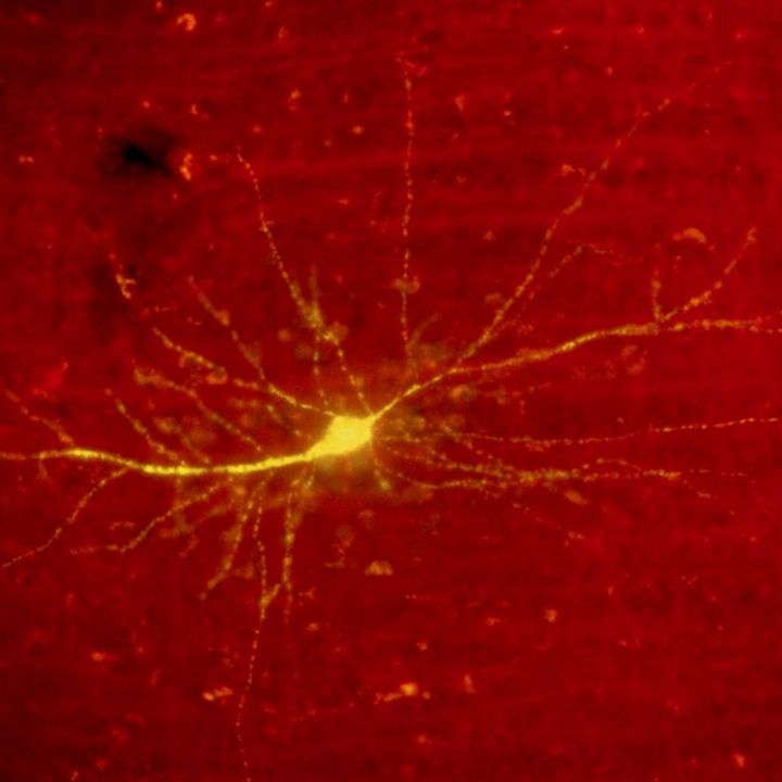 Mémoire: un interrupteur épigénétique qui efface et ravive un souvenir - Sciences & Santé -
                    Luxe radio