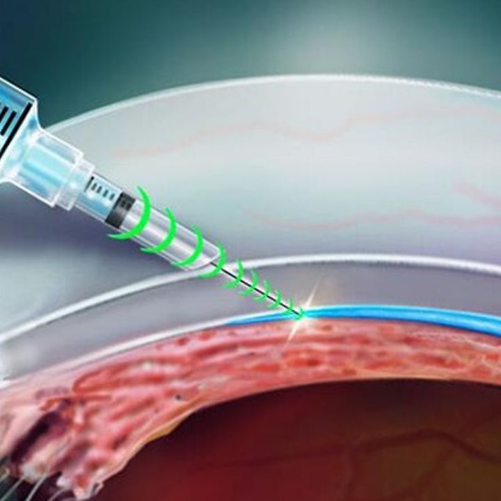 Une injection qui redonne l’ouïe, une percée génétique publiée en juillet 2025 - Sciences & Santé -
                    Luxe radio