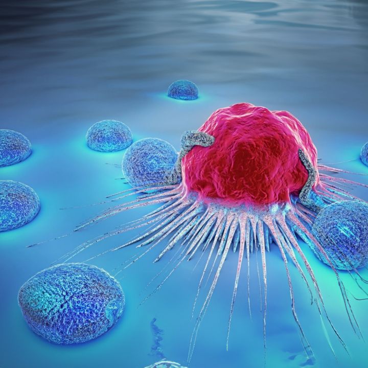 Cancer du sein: un nouvel espoir avec une immunothérapie CAR-T nouvelle génération - Sciences & Santé -
                    Luxe radio