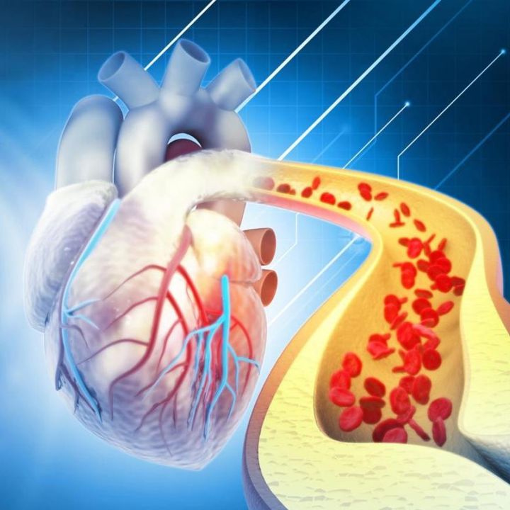 Prévenir la rechute cardiovasculaire: des solutions simples mais sous-utilisées - Sciences & Santé -
                    Luxe radio