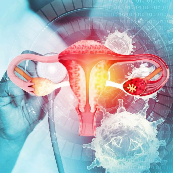 La cancer du col de l’utérus, défi majeur de santé publique - Sciences & Santé -
                    Luxe radio