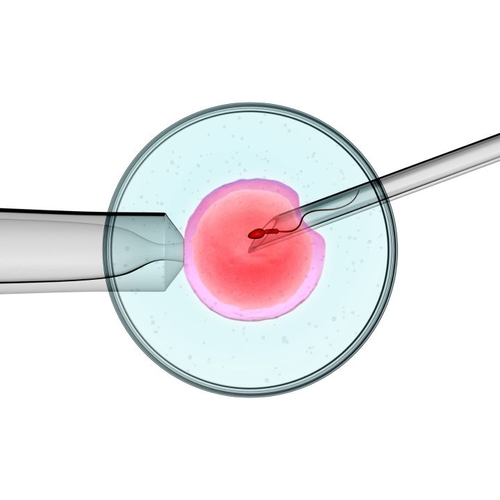Les résultats de la FIV au Maroc sont similaires à ceux en Europe - Les Invités de Heure Essentielle -
                    Luxe radio
