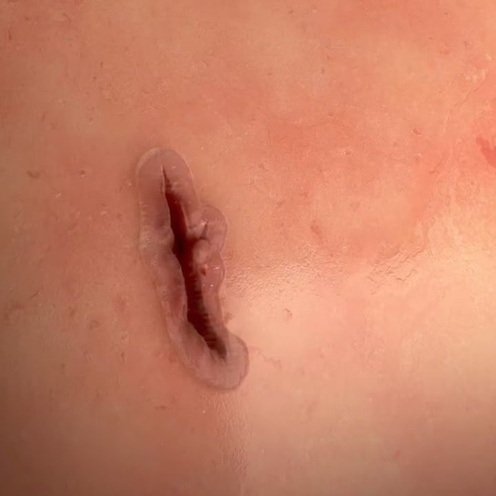 Un gel de soie pour refermer les plaies. - Sciences & Santé -
                    Luxe radio