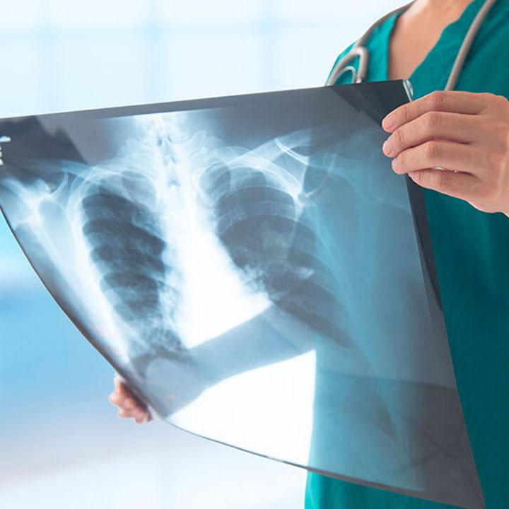 Exclusif : tests pulmonaires ou quand la "race" fausse encore la médecine. - Sciences & Santé -
                    Luxe radio